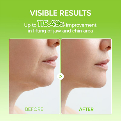 LOVILDS™ V-Lift Mewing Band - Cactus Cooling | De-Puffing & Pore Refining Care